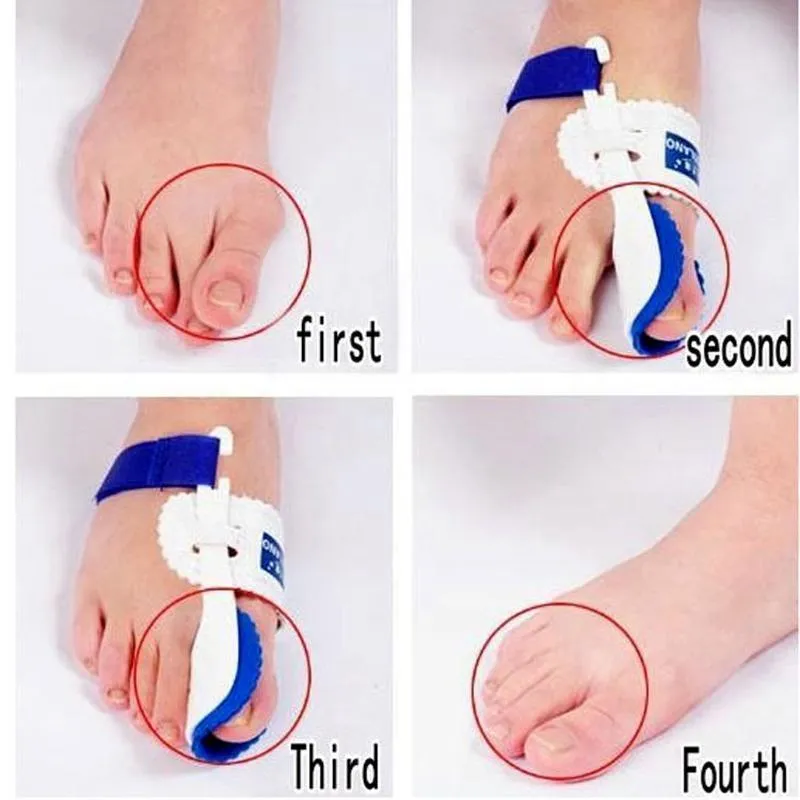 Bunion Adjuster Orthotics
