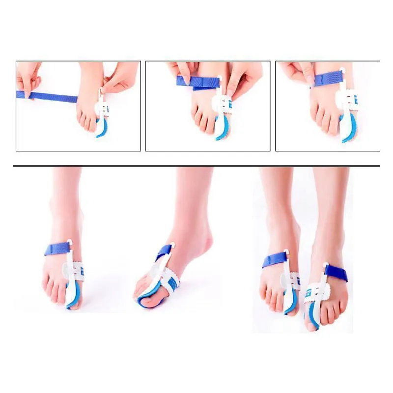 Bunion Adjuster Orthotics